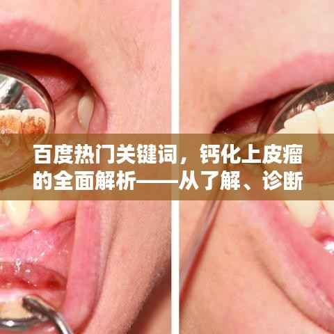 百度热门关键词,钙化上皮瘤的全面解析——从了解、诊断到治疗